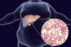 types of liver diseases